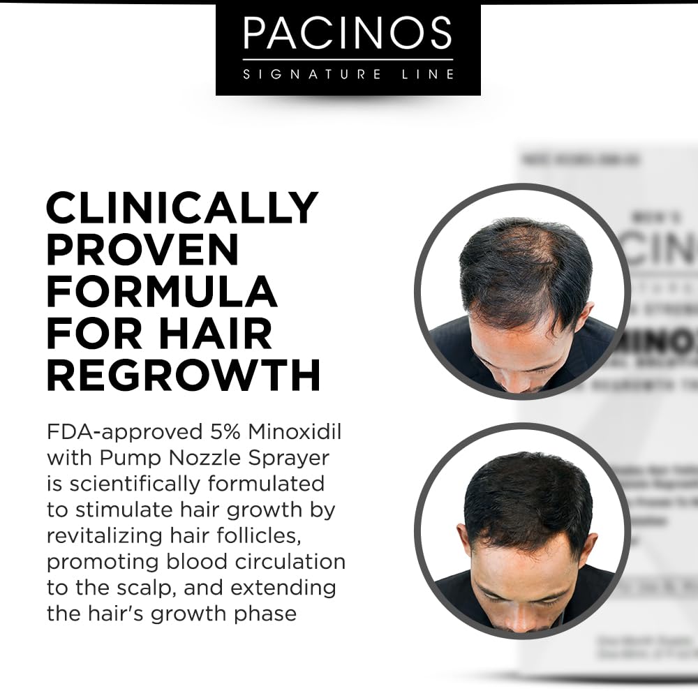 Pacinos Minoxidil 5%Pacinos